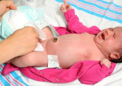 Protección del recién nacido de la listeria