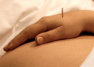 ¿Con qué frecuencia debe hacerse acupunctura durante el embarazo?